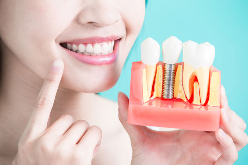 Patient Holding Up A Model Of A Dental Implant In Your Jaw