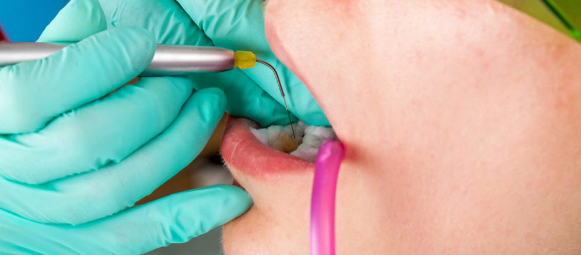 a dental patient receiving laser gum treatment